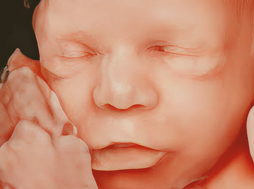 Imagem de bebê em Ultrassom 5D